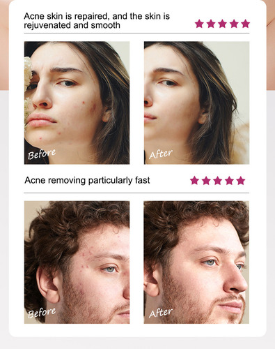 Crema Reparadora C Repair Para Eliminar Marcas Faciales, 15