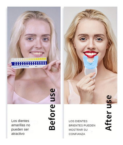 Aparato Para Blanquear Los Dientes Gel De Dientes Que Aclara