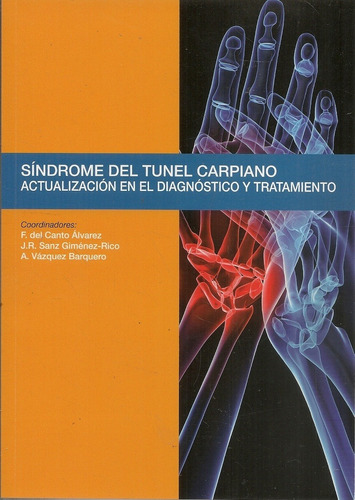 Sindrome Del Tunel Carpiano - Del Canto F - Ergon