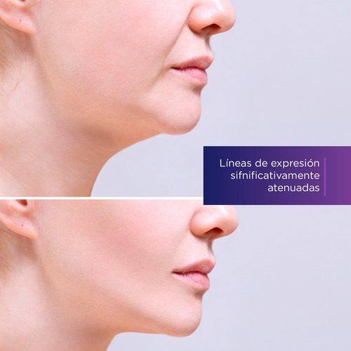 Skinvita Serum Facial Antiedad De Líneas De Expresión 50ml