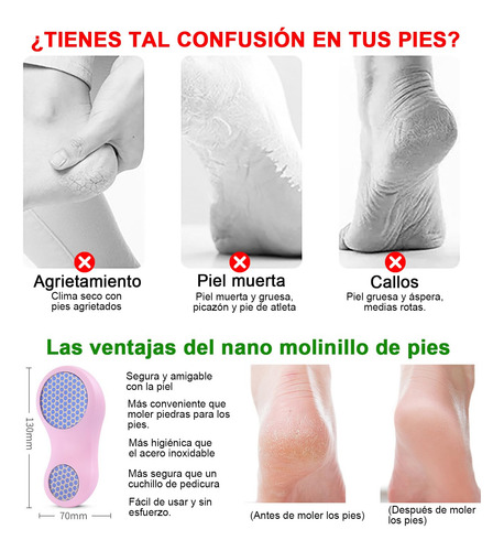 Foot File Lima De Pies Removedor De Callos Para Pies,limas