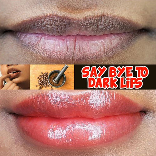 Creme Labial Rosa, Clareamento Rápido, Branqueamento, Tratam