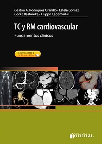 Tc Y Rm Cardiovascular 