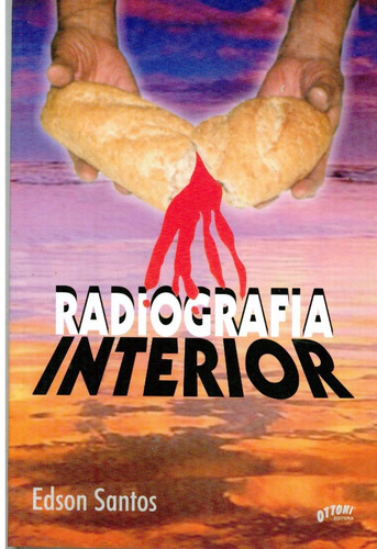 Radiografia Interior - Edson Santos