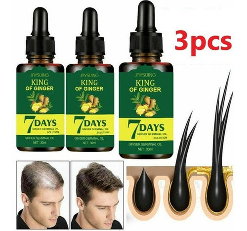 3pcs 30ml Soro Essência Capilar Crescimento Calvície Cabelo