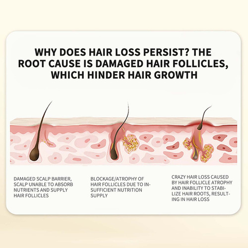 Um Shampoo T Com Extrato Vegetal De Gengibre Para O