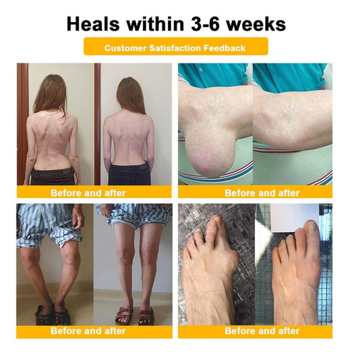 Crema Soft Bee Que No Contiene Toxinas Ni Botulínicas Y
