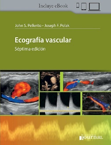 Ecografía Vascular - Pellerito, John S. 