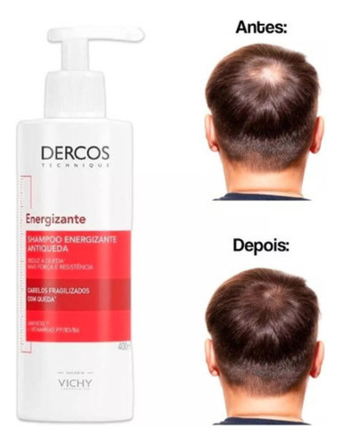 Shampoo Dercos Antiqueda 400ml Kit C/2 Vichy Energizante
