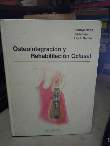 Osteointegracion Y Rehabilitacion Oclusal Sumiya Hobo