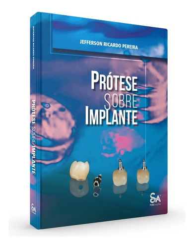 Protese Sobre Implante