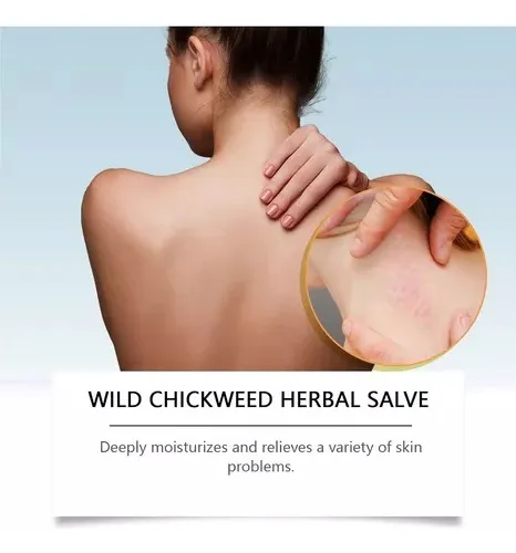 Pomada Herbal De Pamplina Silvestre, Bálsamo De Pamplina Org
