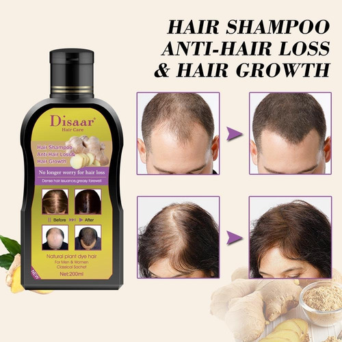 Imagen 3 de 8 de Shampoo Anti Caída De Cabello Reparador Alopecia Y Calvicie