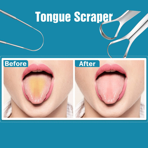 3 Pcs Metal Tongue Scraper, Tongue Scrapers For Adults,