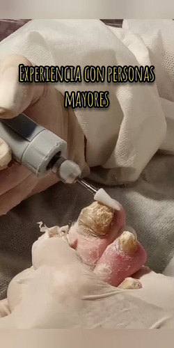 Pedicura A Domicilio