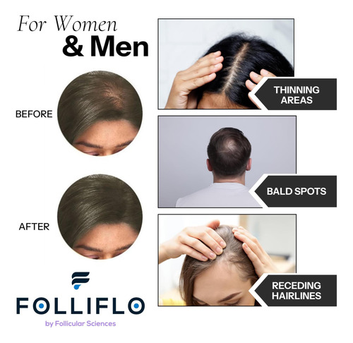 Fibras Para El Cabello De Folliflo Solución Del Cabello De Y
