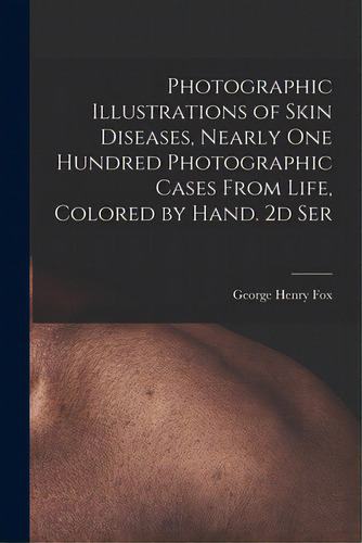 Photographic Illustrations Of Skin Diseases, Nearly One Hundred Photographic Cases From Life, Col..., De Fox, George Henry 1846-1937. Editorial Legare Street Pr, Tapa Blanda En Inglés