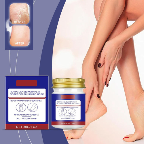 F Hidratante E Antiarranhante Para Mãos E Pés Ant 4001