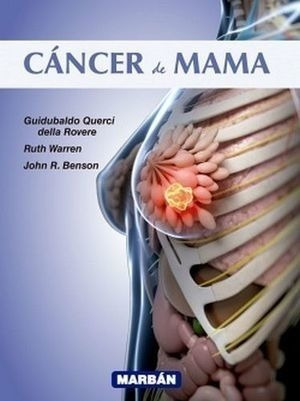 Cancer De Mama