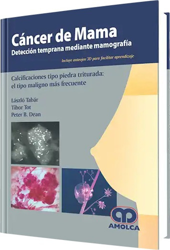 Cáncer De Mama Detección Temprana Mediante Mamografía