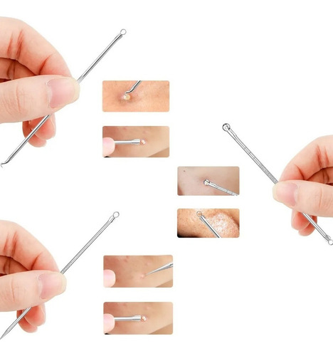 Kit Removedor Extractor Puntos Negros Espinillas Acne 4 Pzs