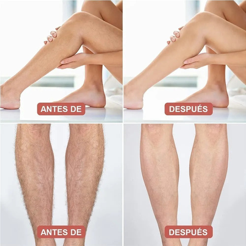 Depiladora de vidro, depiladora, borracha de cabelo, removedor de cor dourada