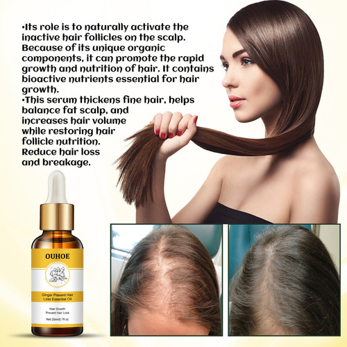 Óleo De Gengibre Para Perda De Cabelo, 20 Ml