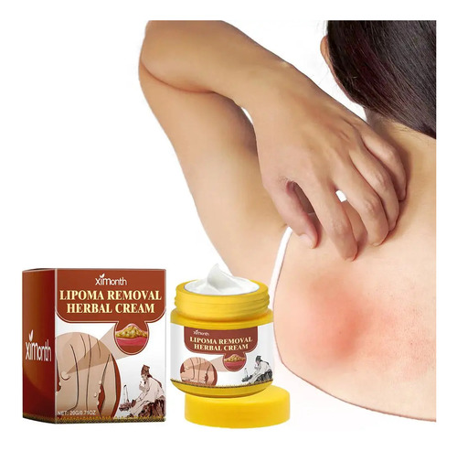 Crema Para Eliminar Bultos Subcutáneos Lipoma Cream, 20 G