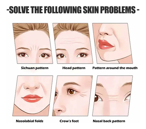 Cinta De Estiramiento Facial, Cinta De Estiramiento Facial I
