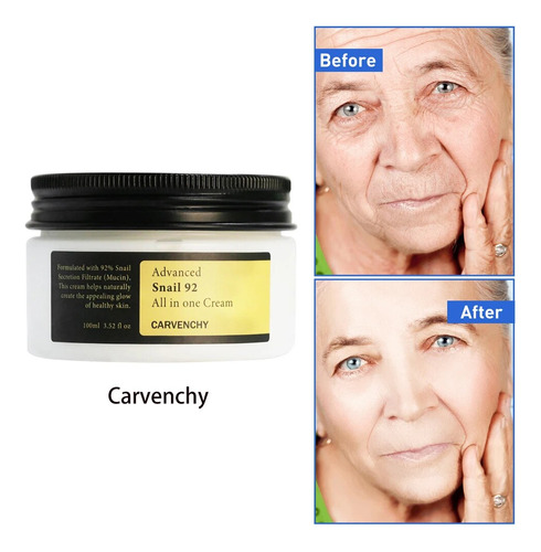 Crema Hidratante Con Forma De Caracol Para Rostro, Esencia,