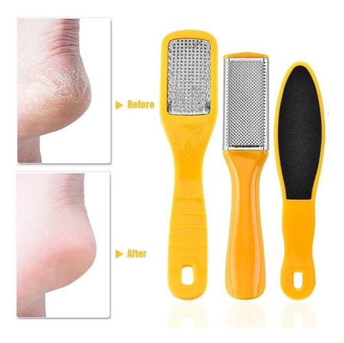 Imagen 3 de 4 de Kit De Pedicura Completo Cuidado De Pies Higiene Salud Set