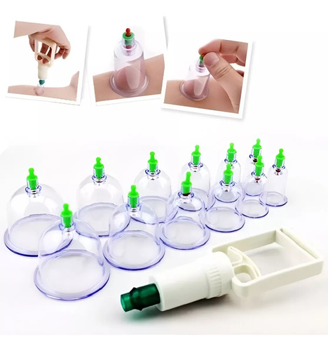 Set 12 Ventosas Chinas Roro Vacumterapia Quita Celulitis