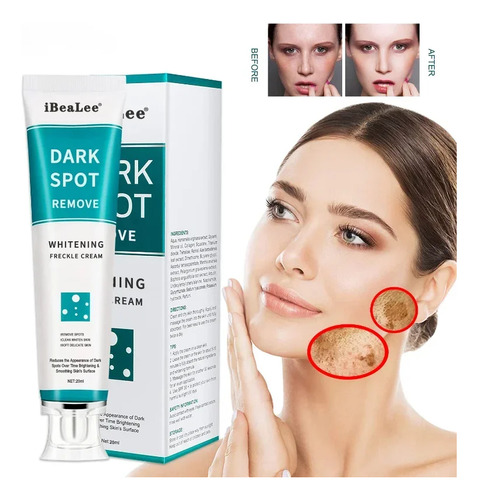 Creme Clareador De Sardas Para Remover Manchas Escuras De Me