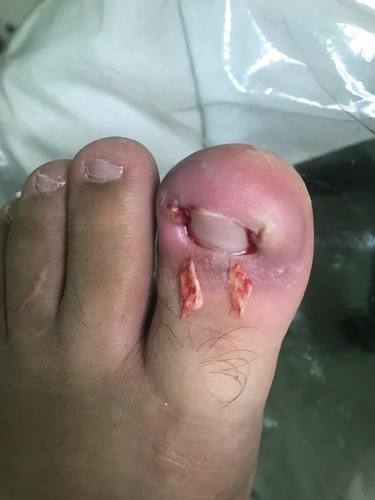 Imagem 5 de 5 de Podologia Ao Seu Alcance