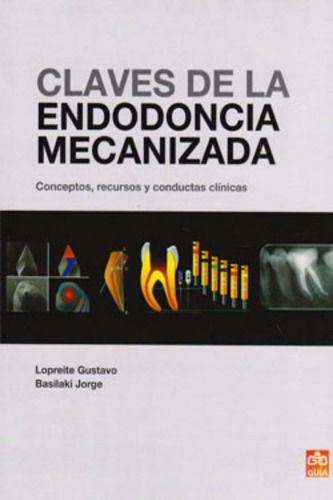 Claves De La Endodoncia Mecanizada. Lopreite