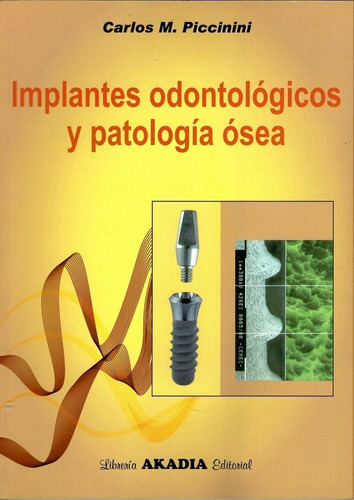 Implantes Odontologicos Y Patologia Osea - Piccinini