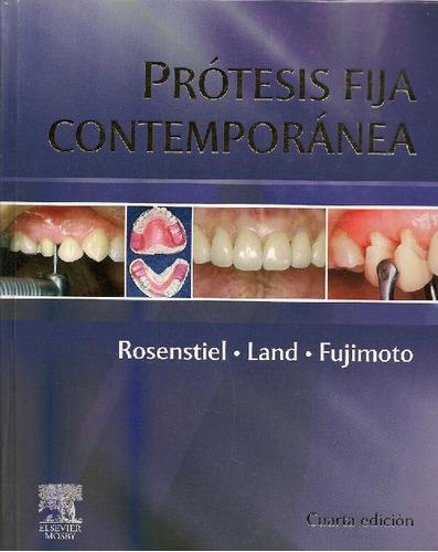 Libro Prótesis Fija Contemporánea De Stephen F. Rosenstiel