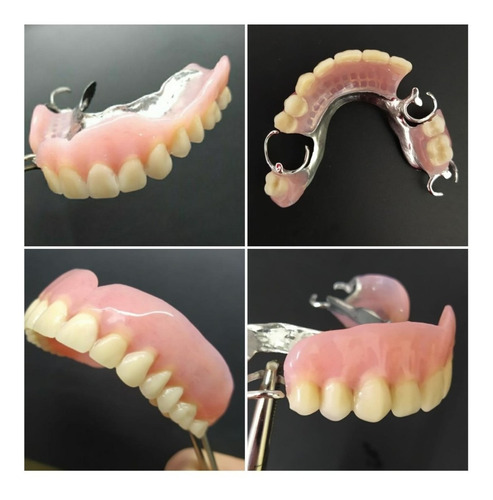 Imagen 4 de 10 de Consultorio Odontológico/ Dentista/ Prótesis Dentales