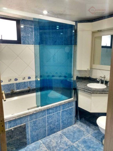 Imagem 28 de 30 de Cobertura Com 3 Dormitórios , Sendo 3 Suites, 390 M² - Venda Por R$ 3.000.000 Ou Aluguel Por R$ 4.500/mês - Vila Santo Estevão - São Paulo/sp - Co0022