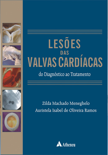 Lesões das válvulas cardíacas - do diagnóstico ao tratamento, de Meneghelo, Zilda Machado. Editora Atheneu Ltda, capa mole em português, 2007