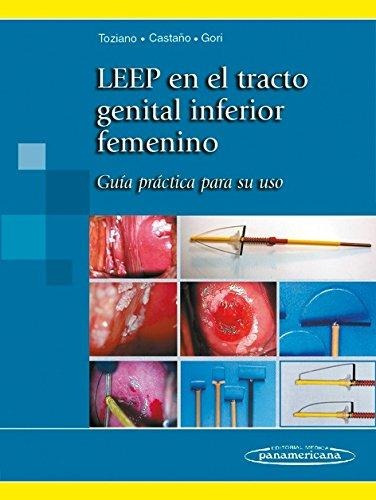 Leep En El Tracto Genital Inferior Femenino - Toziano / Gori