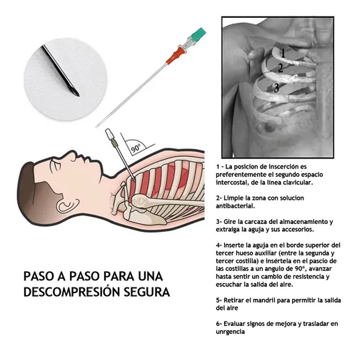 Aguja De Descompresión De Neumotórax Caphstion 14gax 3,25in