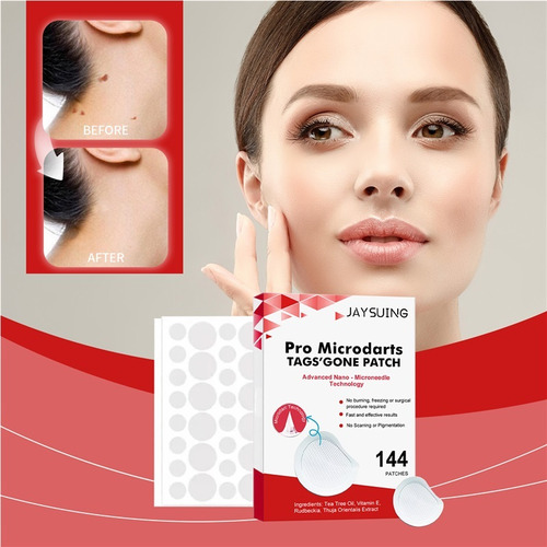 Mp Parche For El Cuidado De La Piel Keyou Nevus