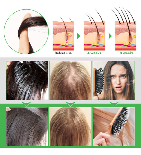 Set Para El Cuidado Del Cabello Rtbyue Aceite De Ricino Negr