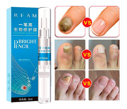 Lapiz Reparador Uñas Hongos Onicomicosis Micosis Pie Atleta