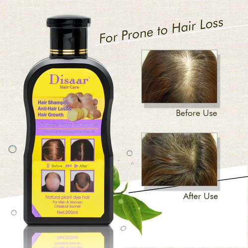 Imagen 7 de 8 de Shampoo Anti Caída De Cabello Reparador Alopecia Y Calvicie
