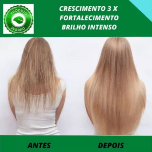 Pantovin Shampoo 1l Tratamento Proa E Pro B5 Contra Calvície