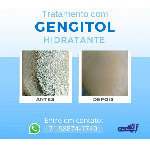 Gengitol Pasta, Indicado Para Fissura E Ressecaento