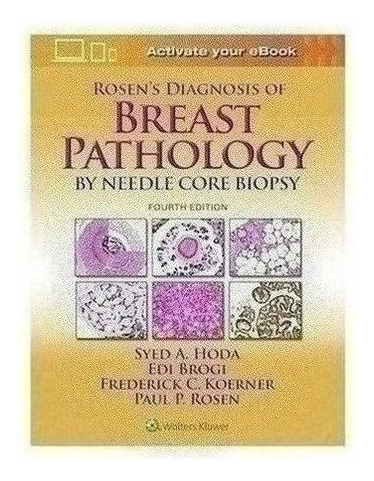 Rosen S Diagnosis Of Breast Pathology By Needle Core Biopsy