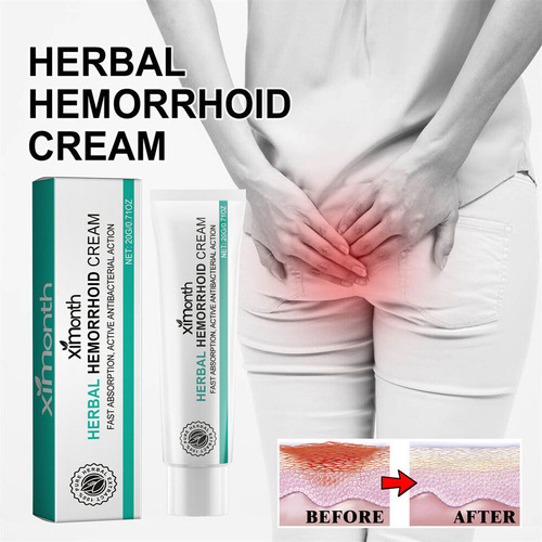 Creme Para Hemorróidas, Pomada Para Aliviar Fissura Anal